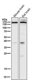All lanes use the Antibody at 1:5K dilution for 1 hour at room temperature.
