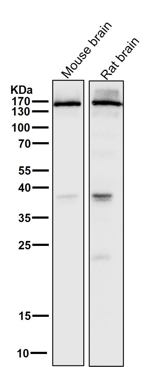 All lanes use the Antibody at 1:5K dilution for 1 hour at room temperature.
