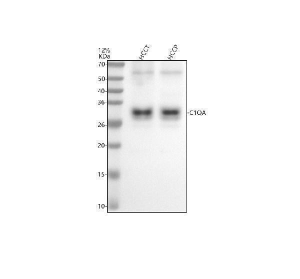 Anti-C1QA Rabbit Monoclonal Antibody