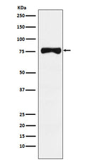 Western blot analysis of TRP1 expression in Human melanoma lysate.