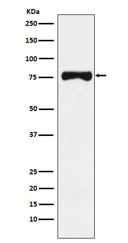 Western blot analysis of TRP1 expression in Human melanoma lysate.