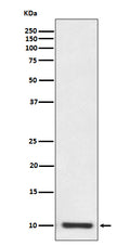 Anti-S100P Rabbit Monoclonal Antibody