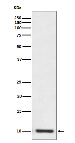 Anti-S100P Rabbit Monoclonal Antibody
