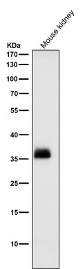 All lanes use the Antibody at 1:1K dilution for 1 hour at room temperature.