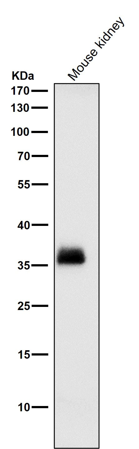 All lanes use the Antibody at 1:1K dilution for 1 hour at room temperature.