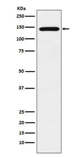 Western blot analysis of Jarid2 expression in NCCIT cell lysate.