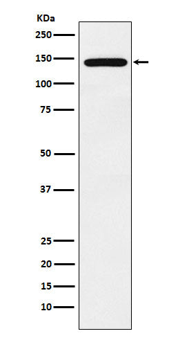 Western blot analysis of Jarid2 expression in NCCIT cell lysate.