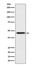 Western blot analysis of ApoA4 expression in Human plasma lysate.
