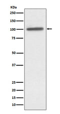 Western blot analysis of alpha Actinin 4 expression in A431 cell lysate.