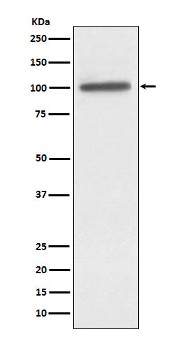 Western blot analysis of alpha Actinin 4 expression in A431 cell lysate.