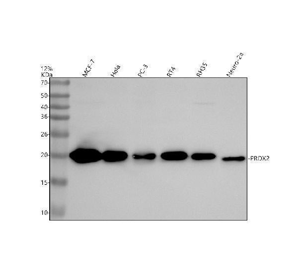 Anti-Peroxiredoxin 2 Rabbit Monoclonal Antibody