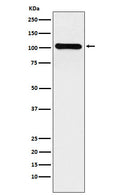 Western blot analysis of BACH1/BRIP1 expression in HeLa cell lysate.