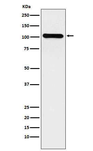 Western blot analysis of BACH1/BRIP1 expression in HeLa cell lysate.