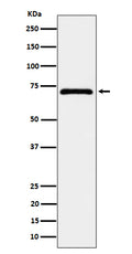 Western blot analysis of EPHX2 expression in MCF7 cell lysate.
