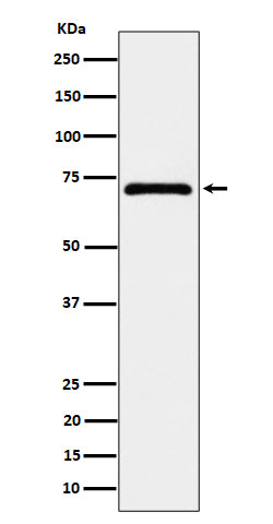 Western blot analysis of EPHX2 expression in MCF7 cell lysate.