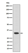 Western blot analysis of Otx2 expression in Y79 cell lysate.