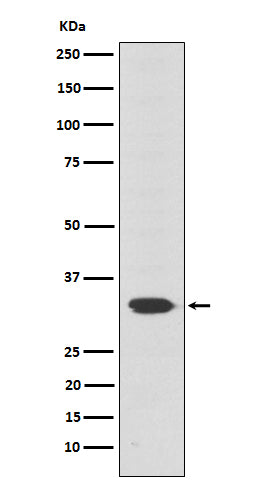 Western blot analysis of Otx2 expression in Y79 cell lysate.