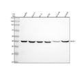 Anti-ACAT1 Rabbit Monoclonal Antibody