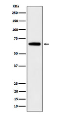 Western blot analysis of IGF2BP2 expression in 293T cell lysate.