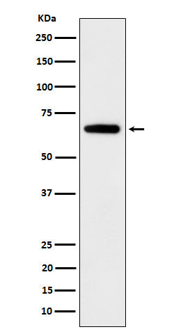 Western blot analysis of IGF2BP2 expression in 293T cell lysate.