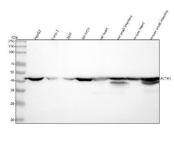 Anti-Actin ACTA1 Rabbit Monoclonal Antibody