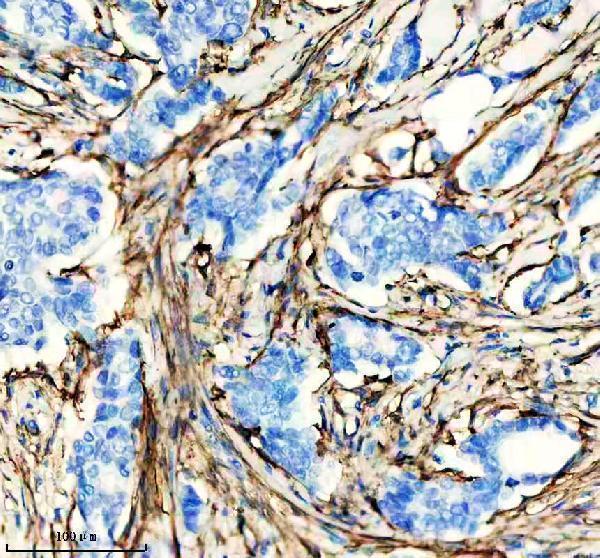 Anti-Actin (Alpha-Actin) ACTA1 Rabbit Monoclonal Antibody