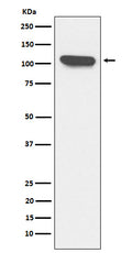 Western blot analysis of ERAP1 expression in K562 cell lysate.