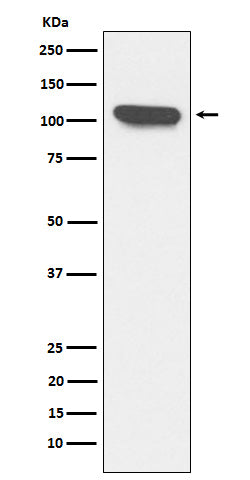 Western blot analysis of ERAP1 expression in K562 cell lysate.