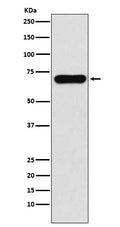 Anti-PCK1 Rabbit Monoclonal Antibody