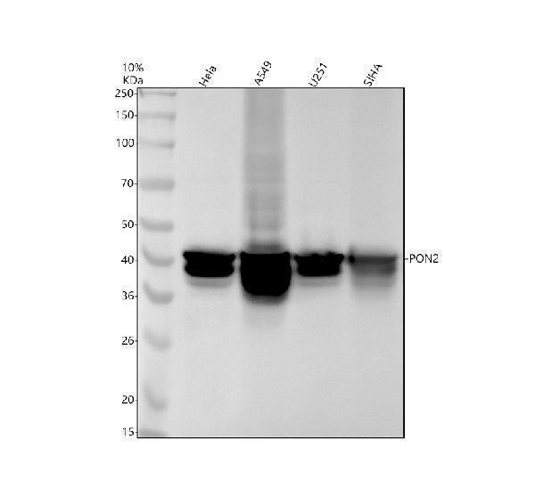 Anti-PON2 Rabbit Monoclonal Antibody