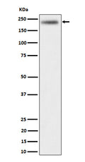 Western blot analysis of DENN expression in HeLa cell lysate.