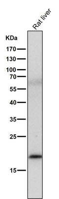 All lanes use the Antibody at 1:1K dilution for 1 hour at room temperature.