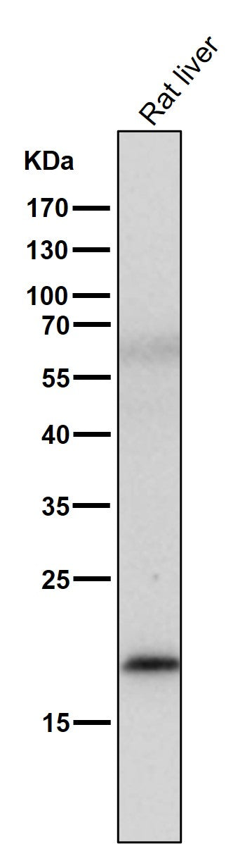 All lanes use the Antibody at 1:1K dilution for 1 hour at room temperature.