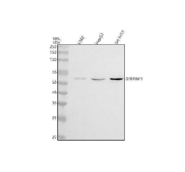 Anti-PEDF Monoclonal Antibody