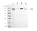 Anti-Desmoglein 2/DSG2 Antibody Picoband® (monoclonal, 2B4D1)