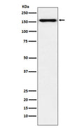 Western blot analysis of Desmoglein 2 expression in HeLa cell lysate.