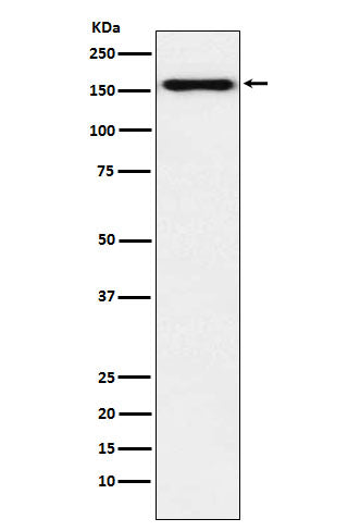 Western blot analysis of Desmoglein 2 expression in HeLa cell lysate.