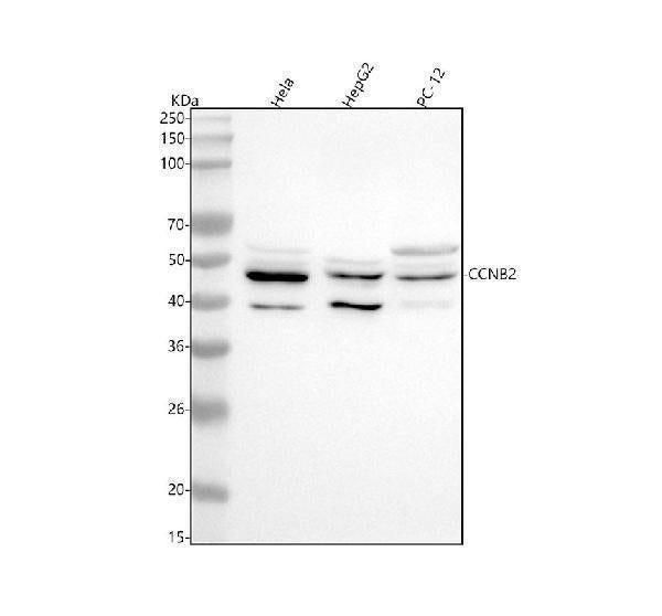 Anti-Cyclin B2 CCNB2 Rabbit Monoclonal Antibody