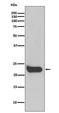 Western blot analysis of Interferon beta expression in HeLa cell lysate.