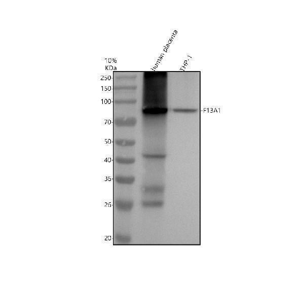 Anti-Factor XIIIa F13A1 Monoclonal Antibody