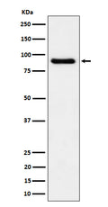 Western blot analysis of C1s expression in human plasma cell lysate.