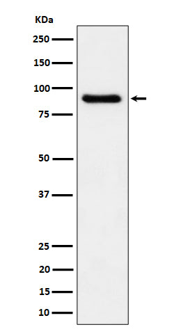 Western blot analysis of C1s expression in human plasma cell lysate.