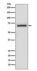 Western blot analysis of A-RAF expression in A375 cell lysate.