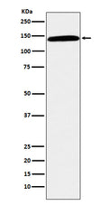 Western blot analysis of CD42b expression in human spleen lysate.