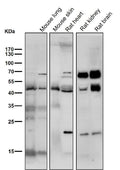 All lanes use the Antibody at 1:3K dilution for 1 hour at room temperature.