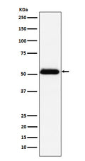 Western blot analysis of Prostatic Acid Phosphatase expression in human prostate cancer lysate.