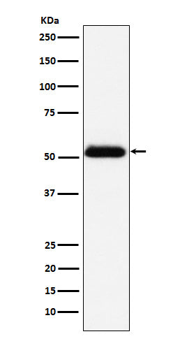 Western blot analysis of Prostatic Acid Phosphatase expression in human prostate cancer lysate.