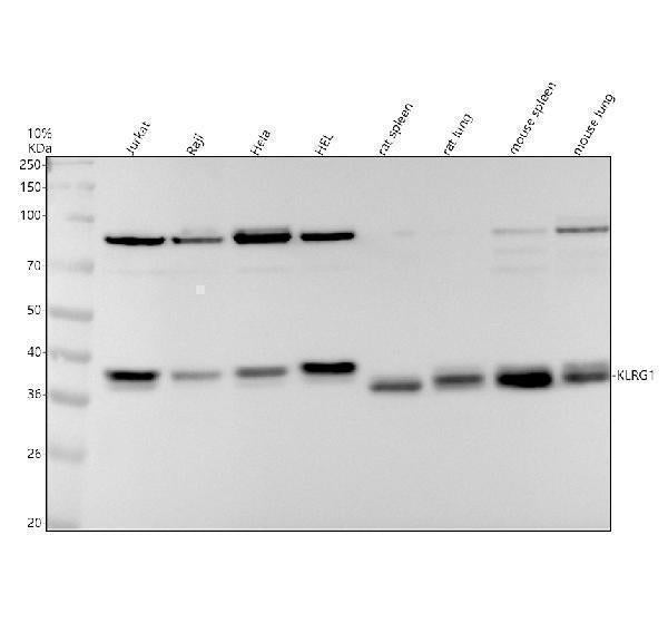 Anti-KLRG1 Rabbit Monoclonal Antibody
