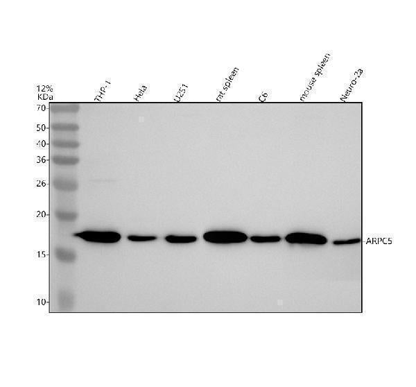 Anti-p16 ARC ARPC5 Rabbit Monoclonal Antibody