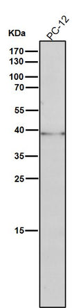 All lanes use the Antibody at 1:1K dilution for 1 hour at room temperature.